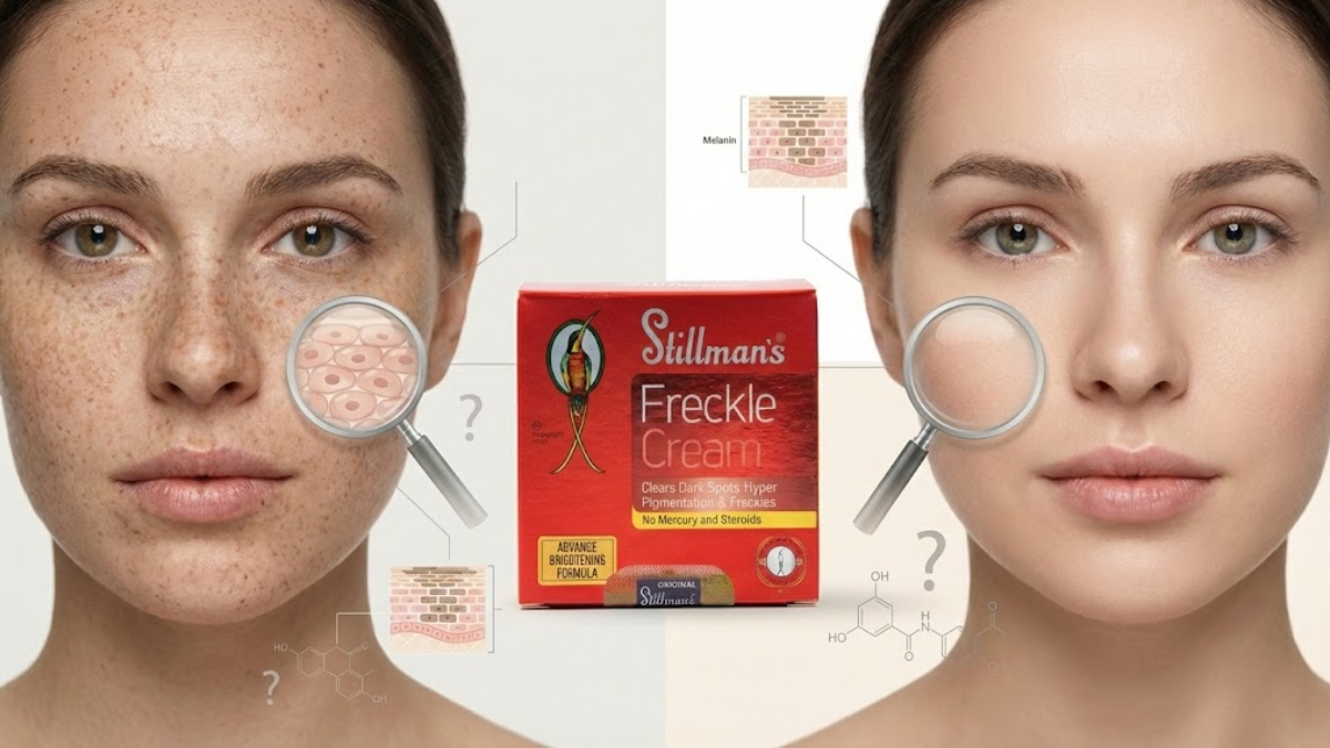 Can Stillman's Anti-Mercury Cream Remove Freckles?  Stillmans Beauty