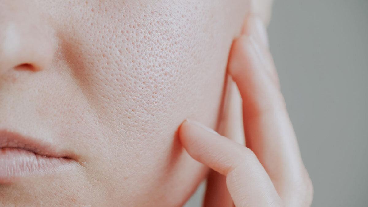 How to Minimize Pores on the Face