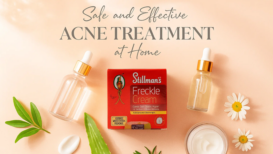 Safe and Effective Acne Treatment at Home