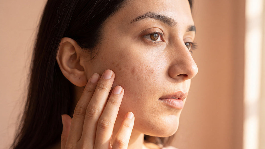 Dark Spots