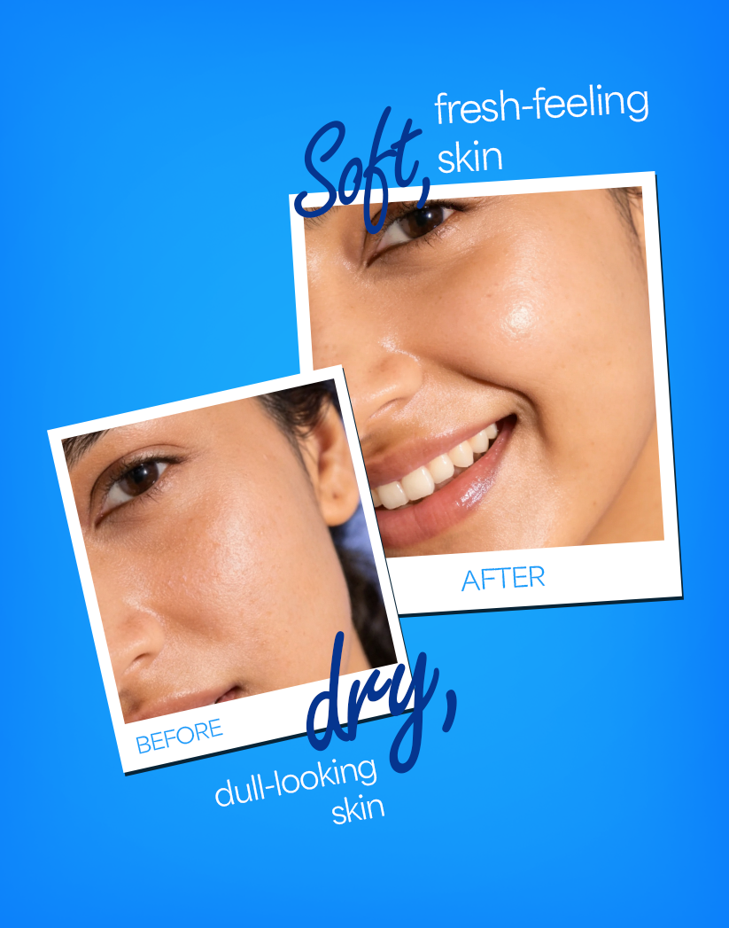 Soft Light Moisturising Cream