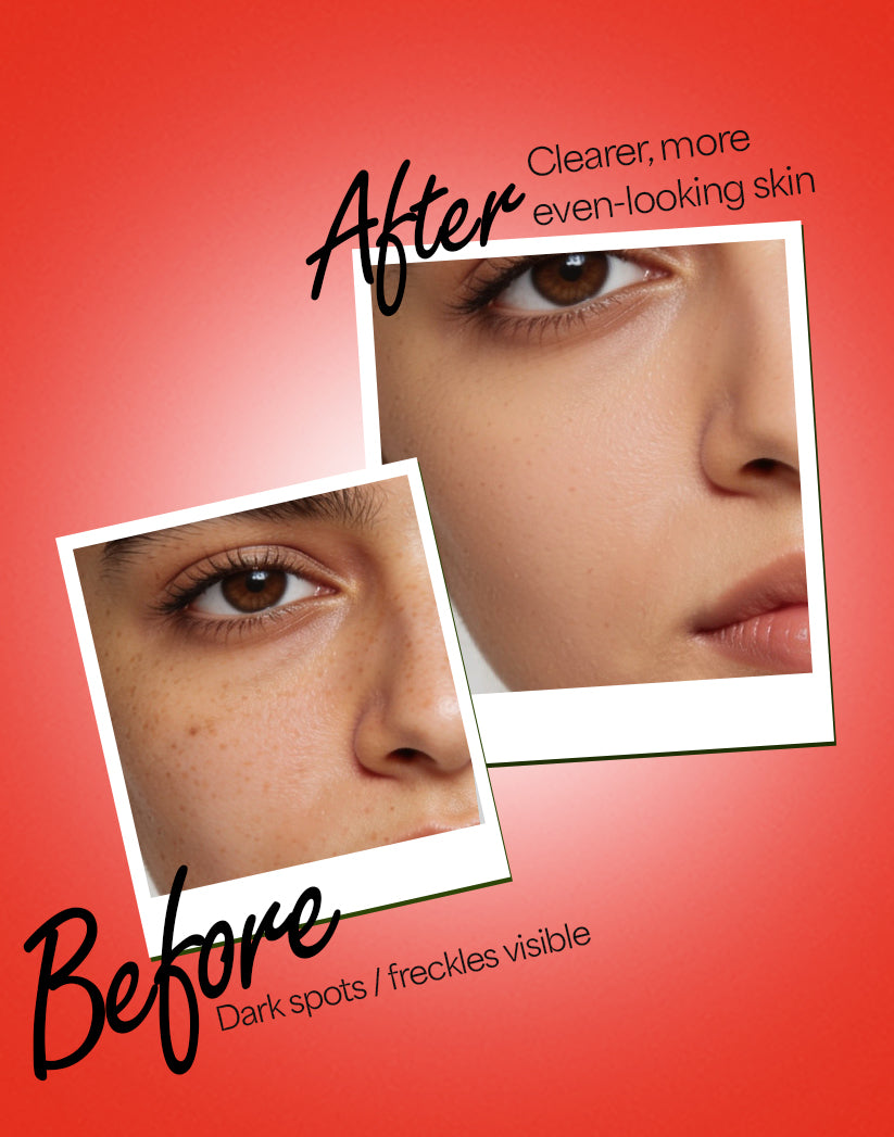 Freckle Cream Export Version