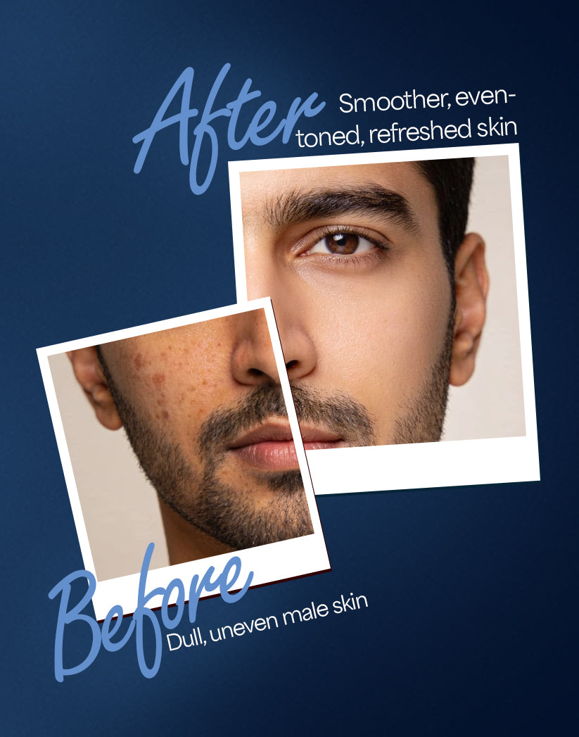 Men's Fairness Cream